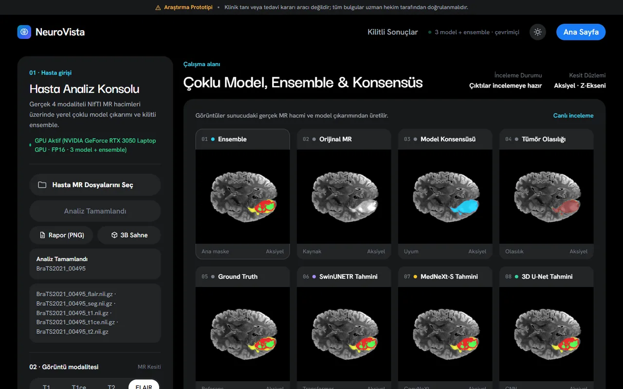 The analysis console showing one MRI slice eight times, for the ensemble mask, the original scan, the model agreement map, the tumour probability, the ground truth and each of the three models.
